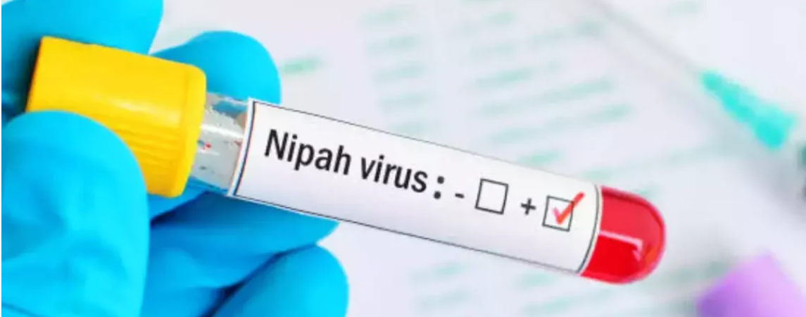 Nipah Virüsü Belirtileri: Nedir? Önlemler ve bilmeniz gereken her şey!